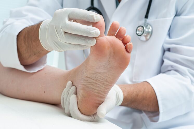 dermatolog bada nogi pacjenta