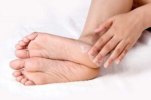 leczenie kremu przeciwgrzybiczego skóry stóp